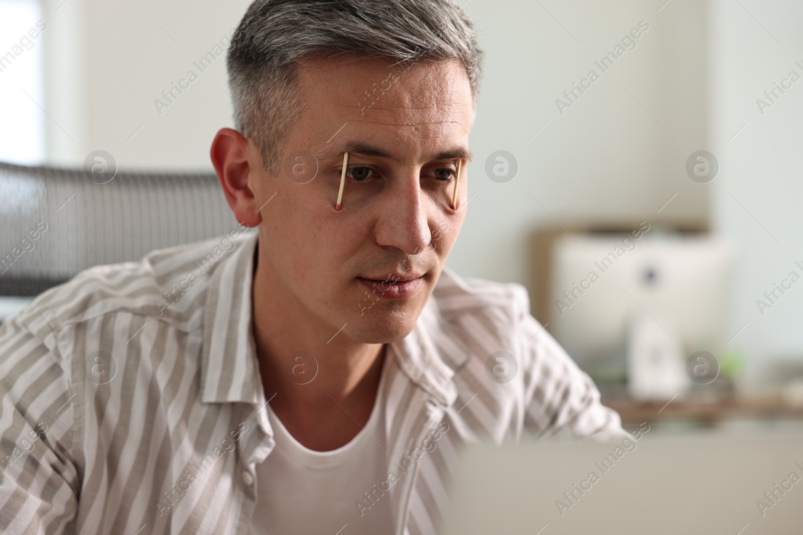 Photo of Sleepy man keeping eyes wide open with matches at workplace in office