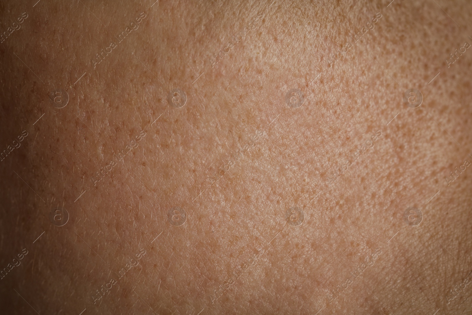 Photo of Texture of human skin as background, closeup view