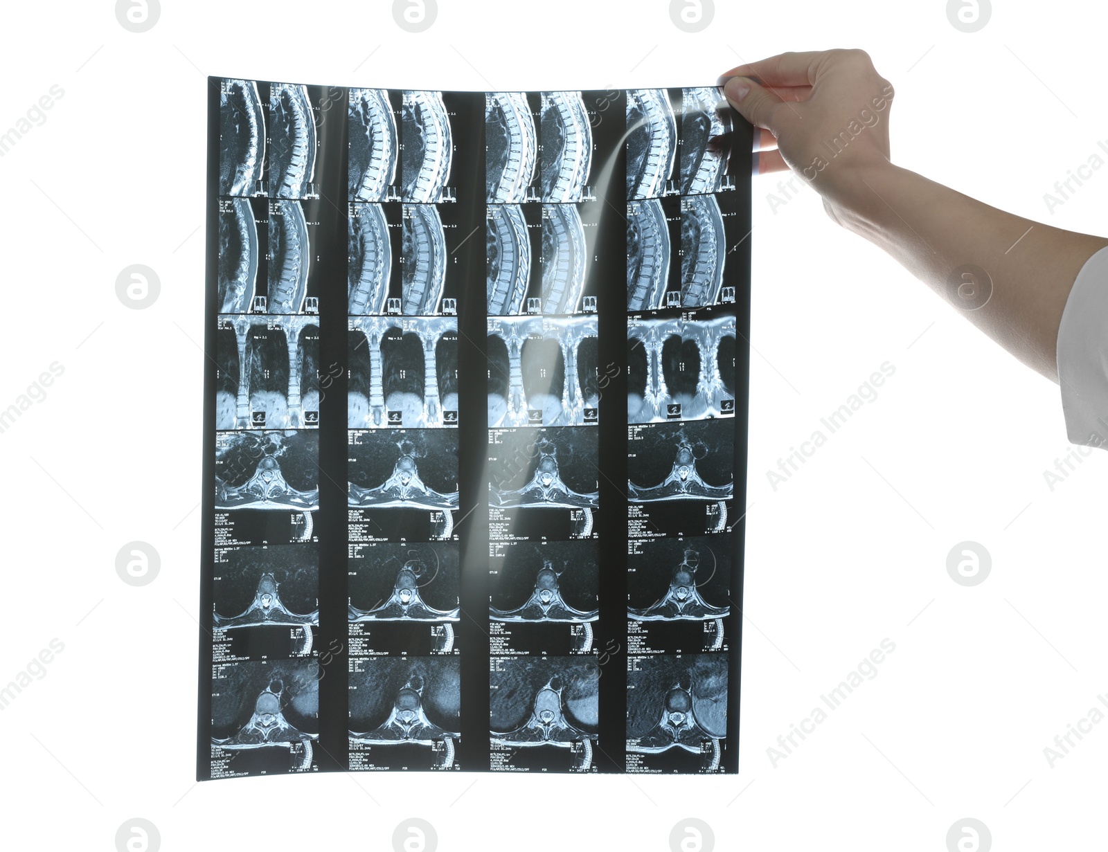 Photo of Doctor examining neck MRI image on white background, closeup