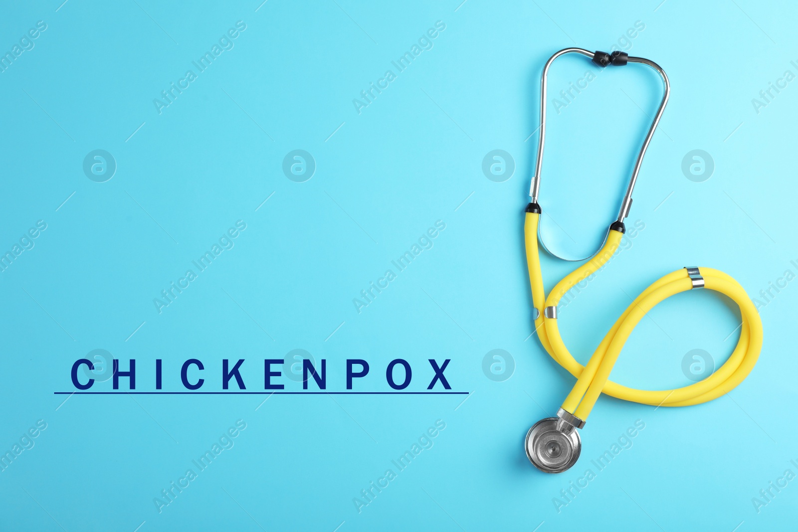 Image of Stethoscope on light blue background, top view. Chickenpox disease 