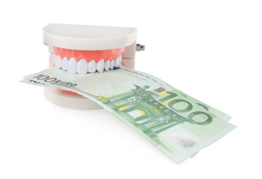 Photo of Educational dental typodont model with euro banknotes on white background. Expensive treatment