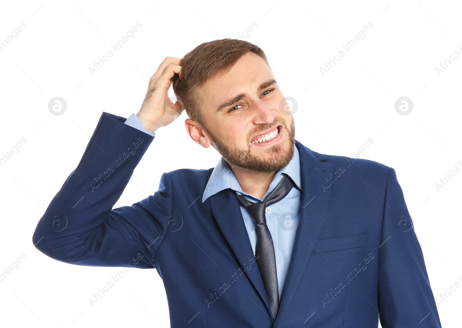 Photo of Young man scratching head on white background. Annoying itch