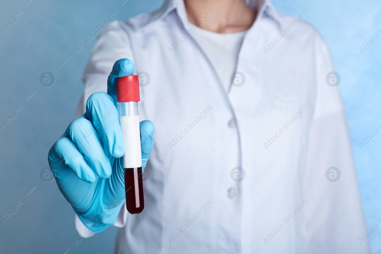 Photo of Doctor holding glass tube with blood on color background, closeup. Allergy test