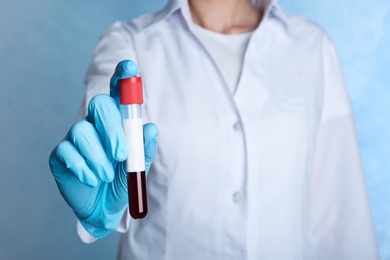 Photo of Doctor holding glass tube with blood on color background, closeup. Allergy test