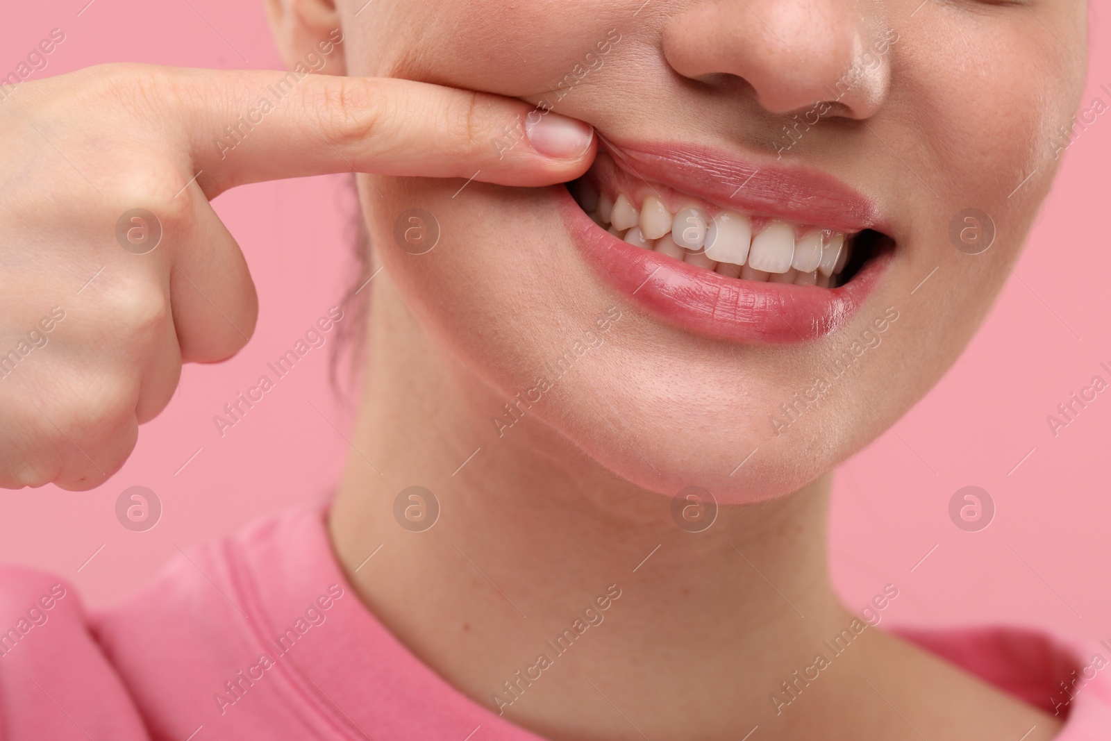 Photo of Beautiful woman showing her clean teeth on pink background, closeup