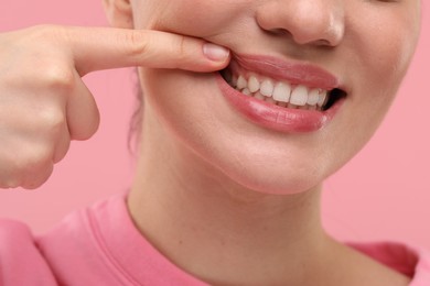 Beautiful woman showing her clean teeth on pink background, closeup