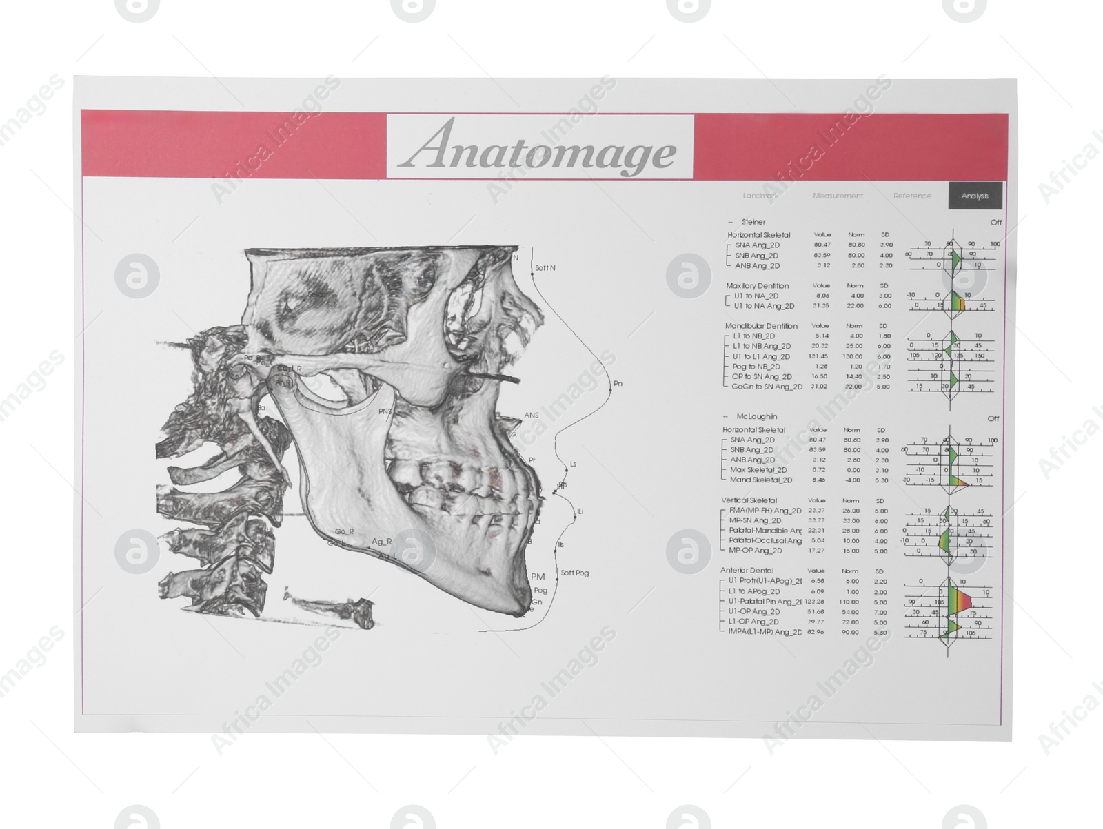 Photo of Visualization of human maxillofacial section for dental analysis printed on paper isolated on white