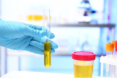 Photo of Laboratory assistant holding test tube with urine sample for analysis indoors, closeup