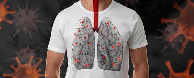 Image of Man with diseased lungs surrounded by viruses on dark background