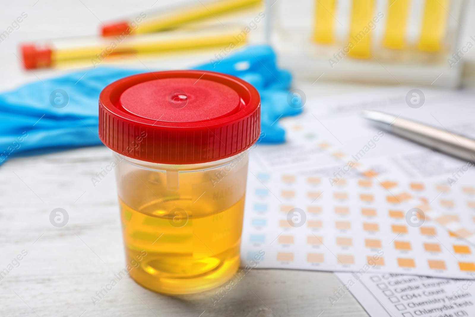 Photo of Jar with urine sample on table. Urology concept