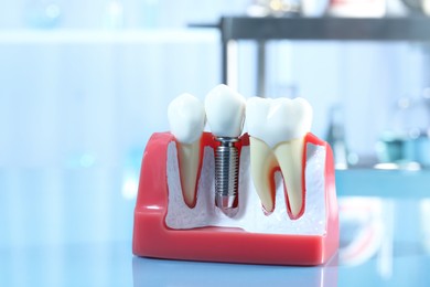 Educational model of gum with dental implant between teeth indoors