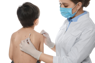 Photo of Doctor applying cream onto skin of little boy with chickenpox against white background. Varicella zoster virus