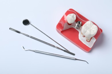 Educational model of gum with post for dental implant between teeth and medical tools on white background, top view
