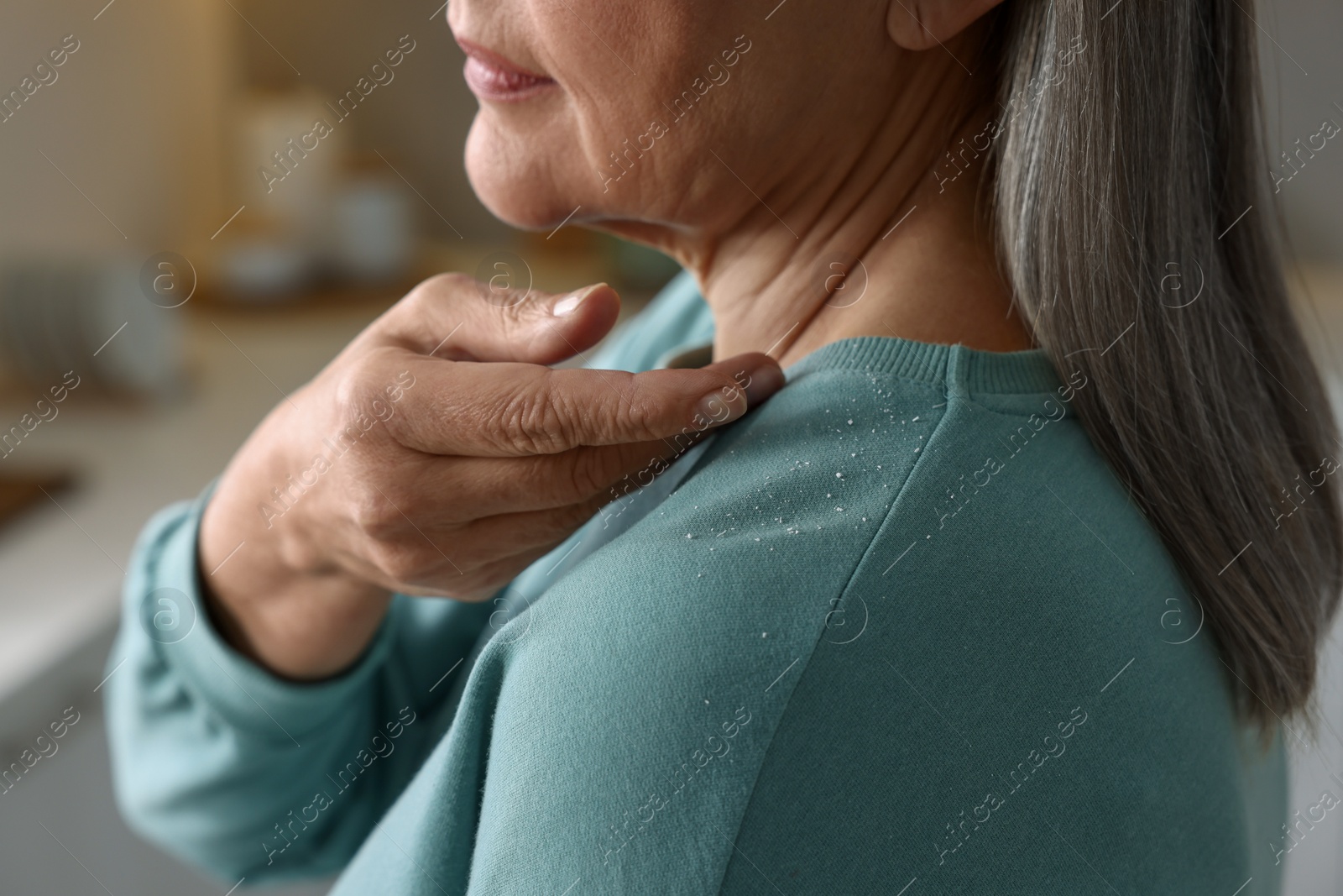 Photo of Woman brushing dandruff off her sweater indoors, closeup