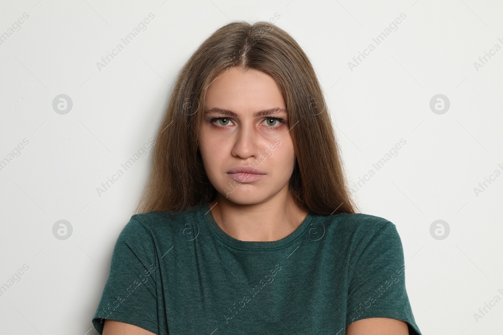 Photo of Portrait of abused young woman on light background. Stop violence