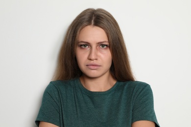 Portrait of abused young woman on light background. Stop violence