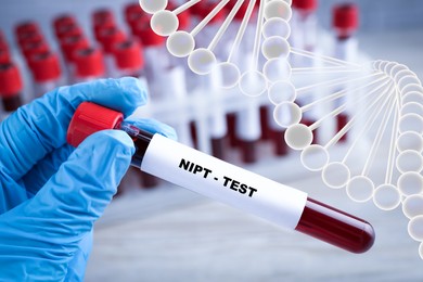 Image of Noninvasive prenatal testing (NIPT). Nurse holding test tube with blood sample in laboratory, closeup. Illustration of DNA structure