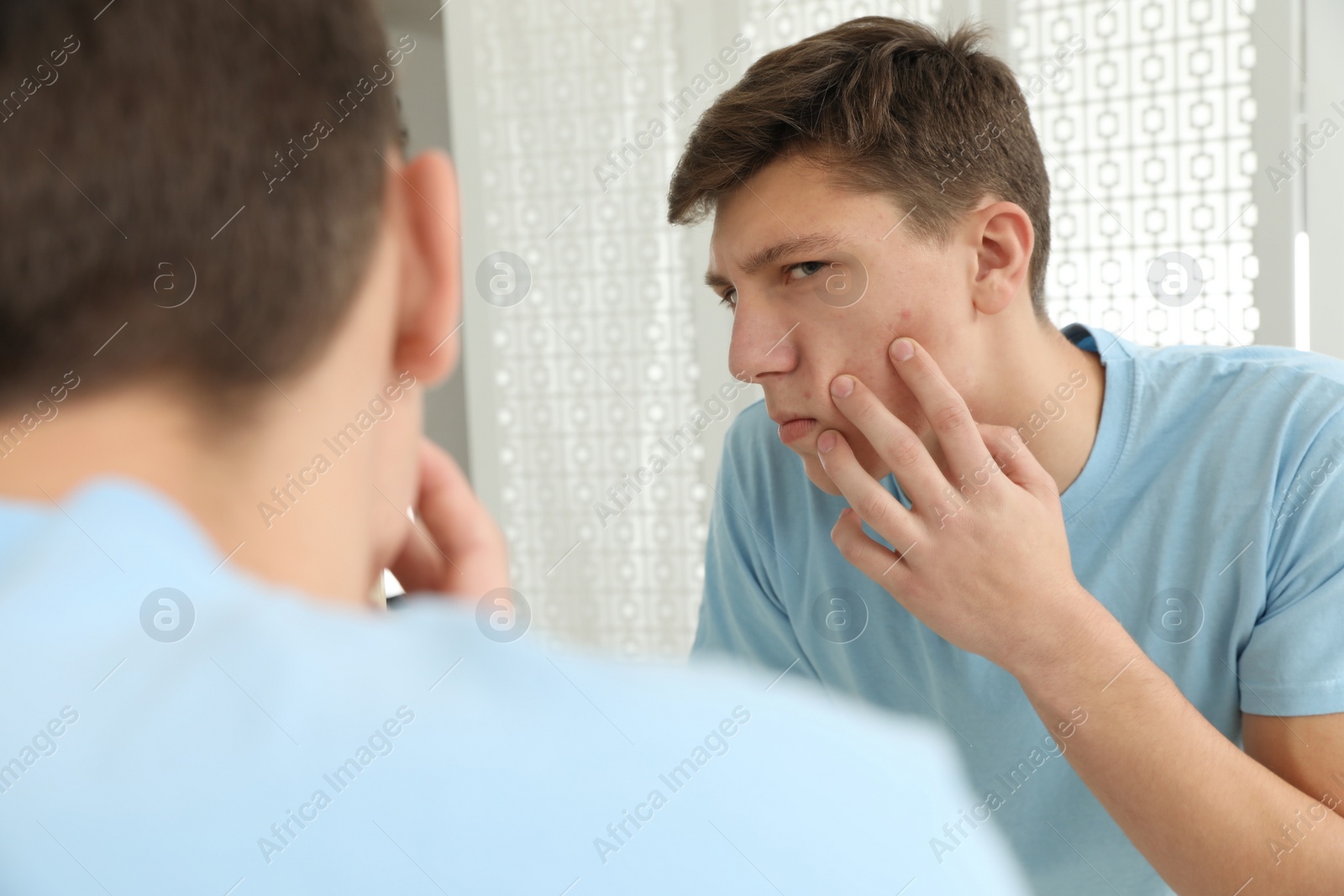 Photo of Teen guy with acne problem near mirror indoors