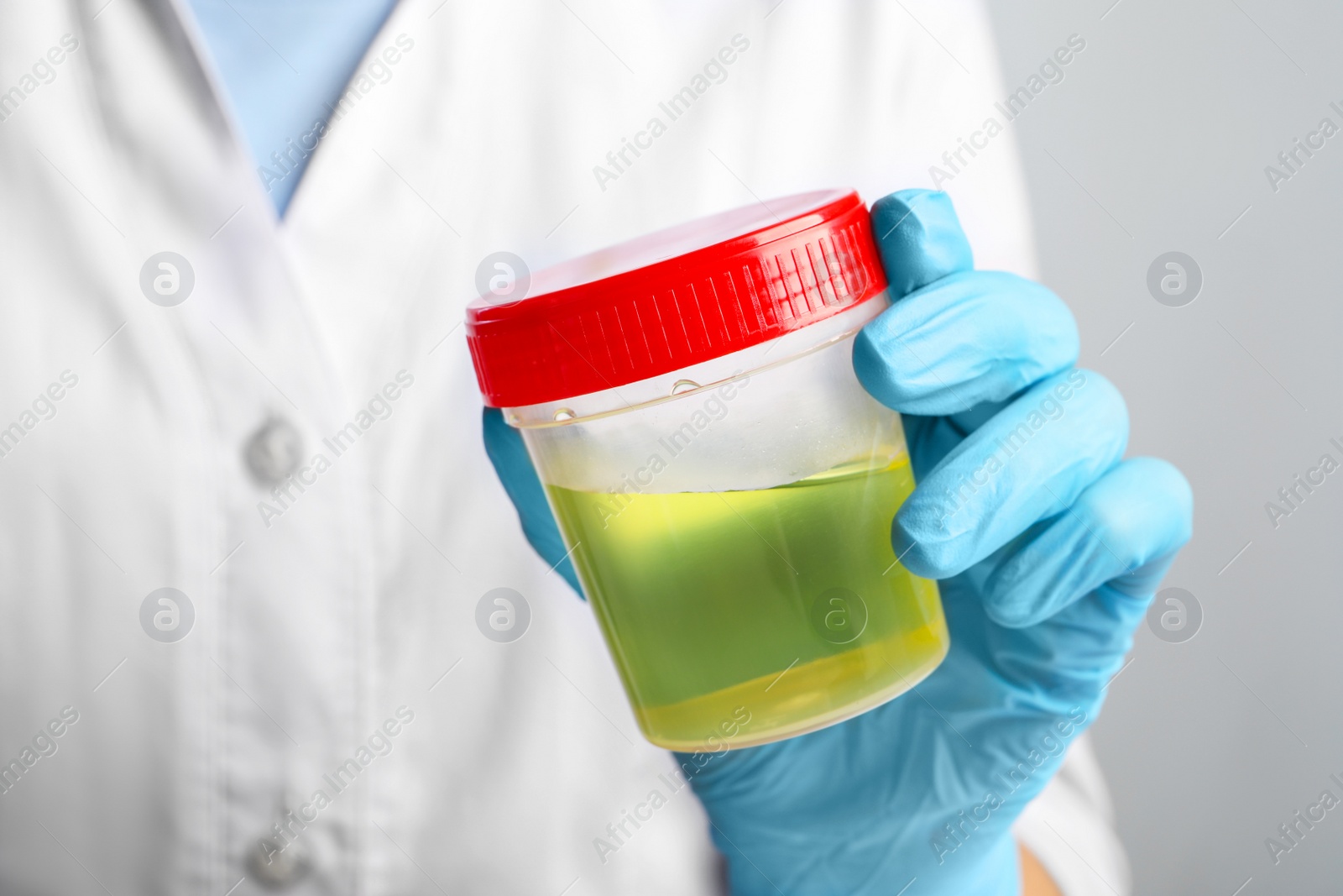 Photo of Doctor holding container with urine sample for analysis on grey background, closeup