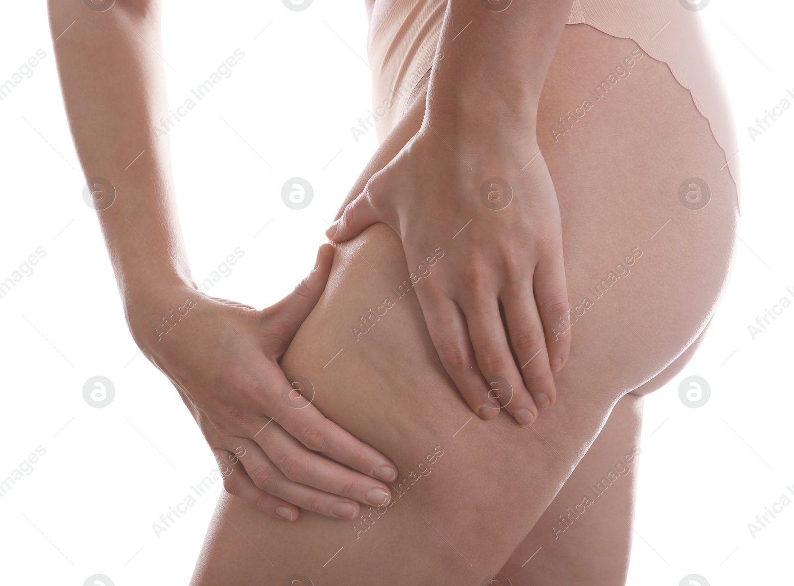 Photo of Woman with cellulite on white background, closeup