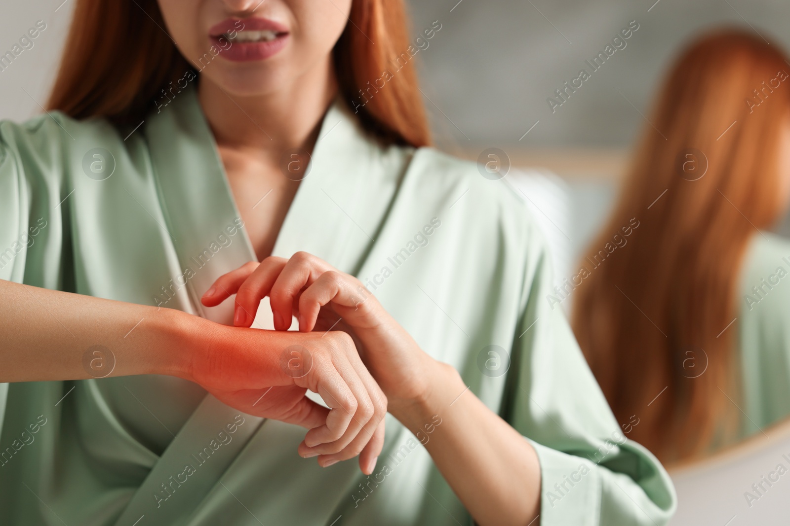 Photo of Suffering from allergy. Young woman scratching her arm indoors, closeup. Space for text