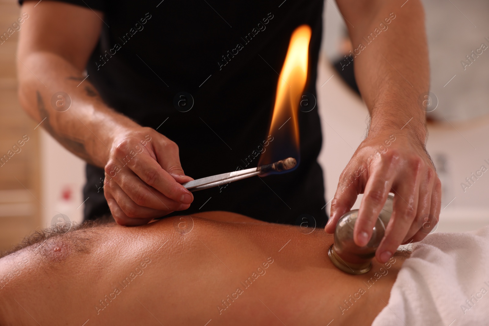 Photo of Therapist giving fire cupping treatment to patient indoors, closeup