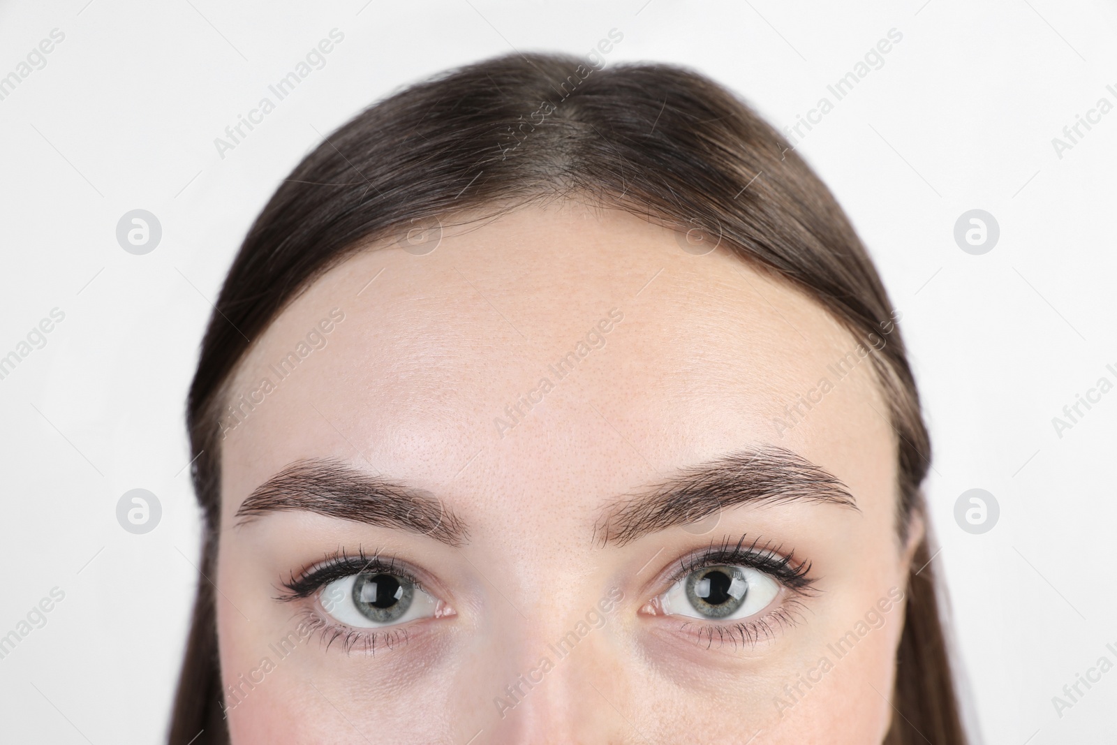 Photo of Woman with dry skin on white background, closeup