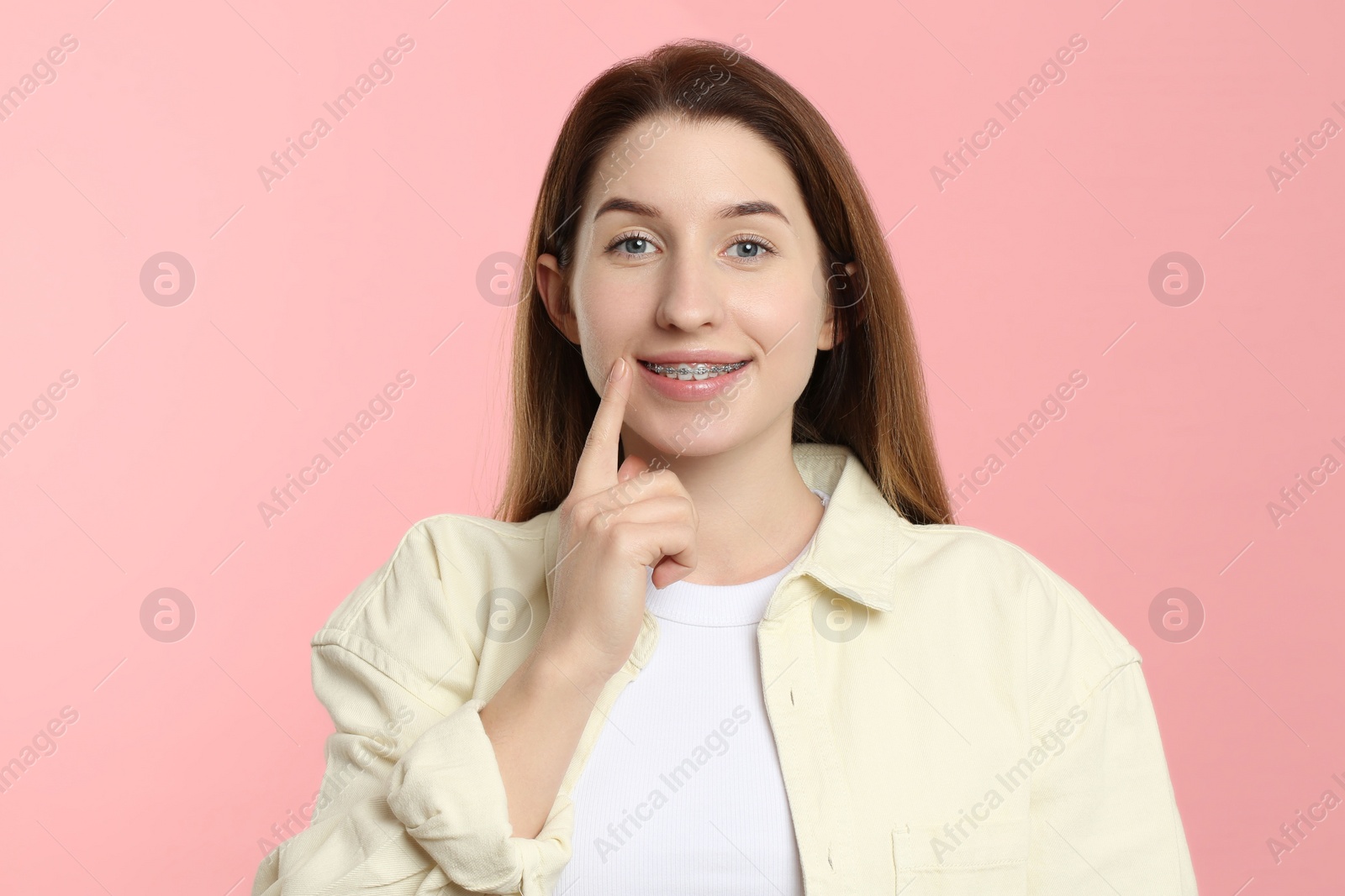 Photo of Portrait of smiling woman pointing at her dental braces on pink background