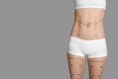 Photo of Young woman with marks on belly and legs for cosmetic surgery operation against color background