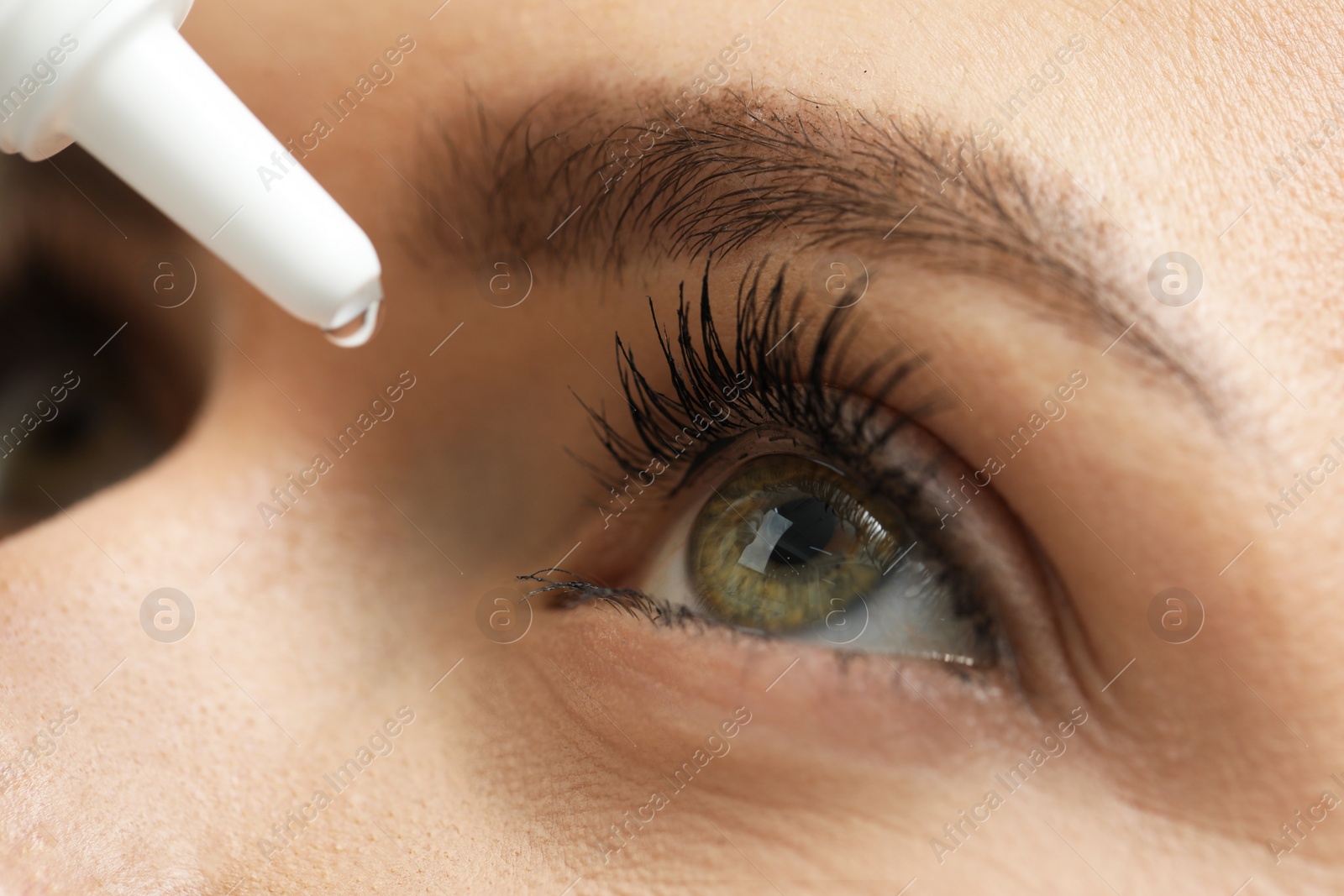 Photo of Woman applying medical eye drops, macro view
