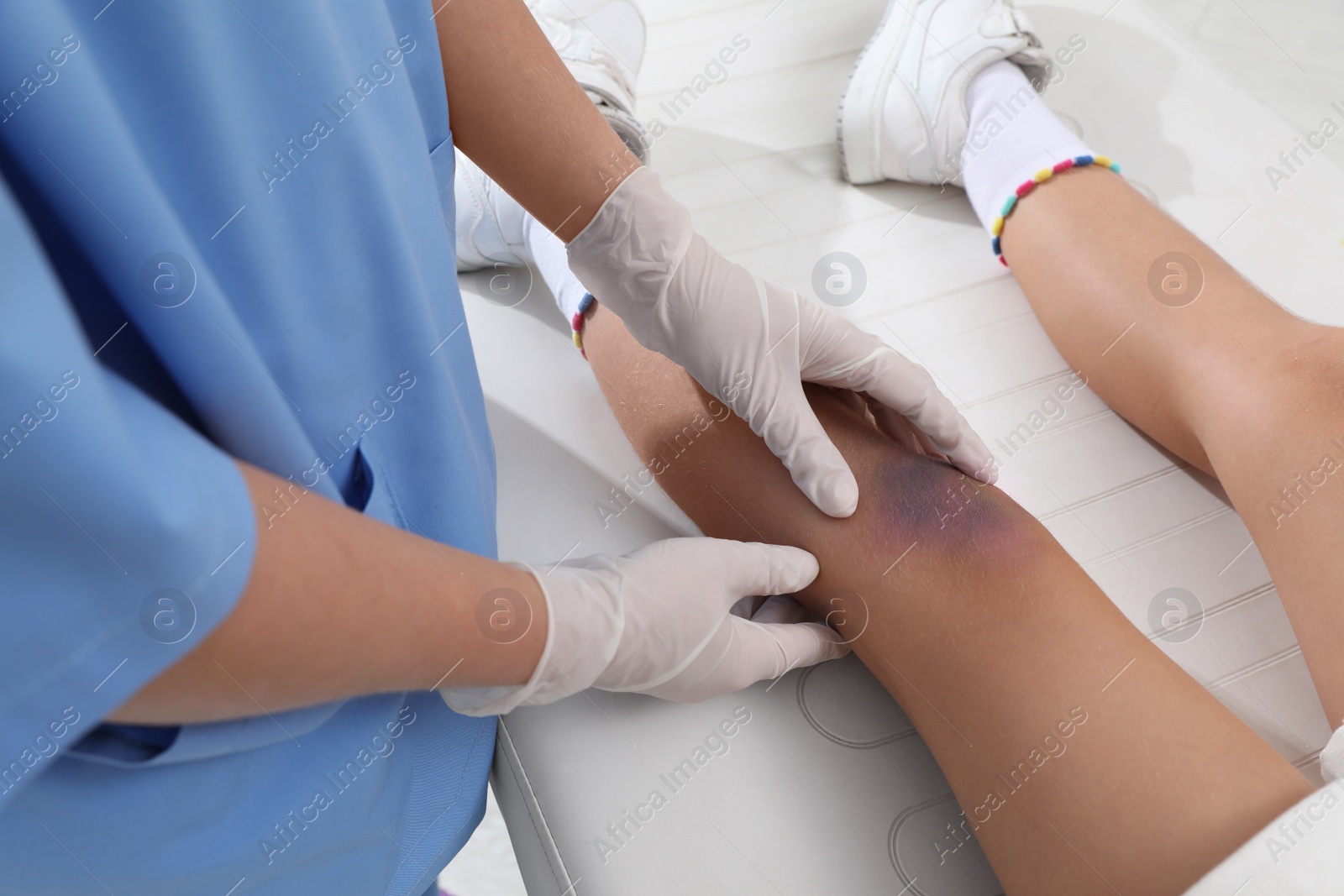 Photo of Doctor examining little child's bruised knee in hospital, closeup