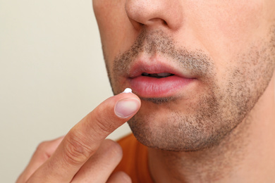 Image of Young man with cold sore applying cream on lips against light background, closeup