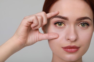 Woman with yellow eyes on light grey background. Symptom of hepatitis