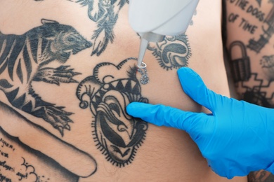 Person undergoing laser tattoo removal procedure in salon, closeup