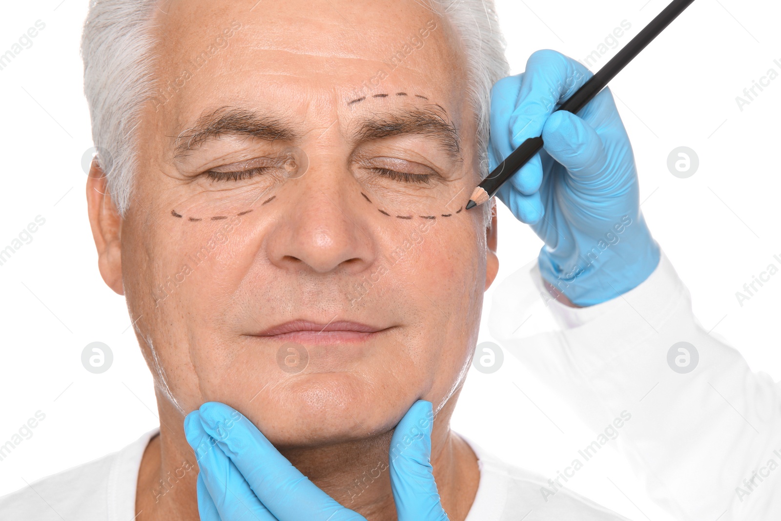 Photo of Doctor marking senior man face before cosmetic surgery on white background