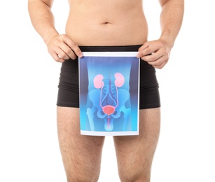 Photo of Young man holding picture of urinary system on white background