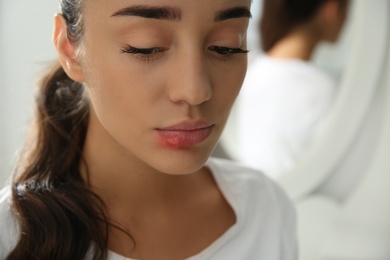 Photo of Young woman with herpes on lip against blurred background, closeup