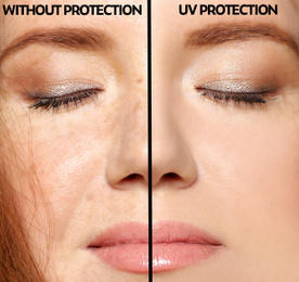 Young woman without and with sun protection cream on her face, closeup