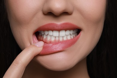 Young woman showing healthy gums, closeup view