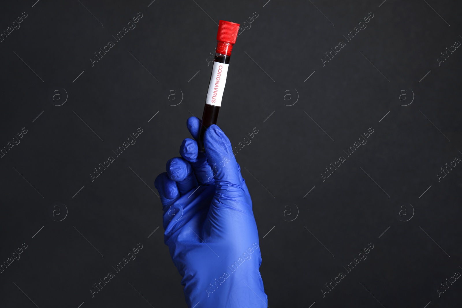 Photo of Scientist holding test tube with blood sample and label CORONA VIRUS on black background, closeup