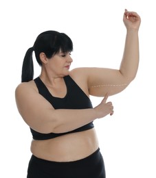 Photo of Obese woman with flabby arm on white background. Weight loss surgery