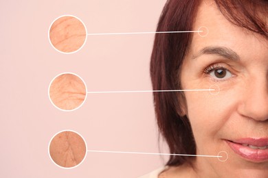 Beautiful mature woman on beige background, closeup. Zoomed skin areas showing wrinkles before rejuvenation procedures