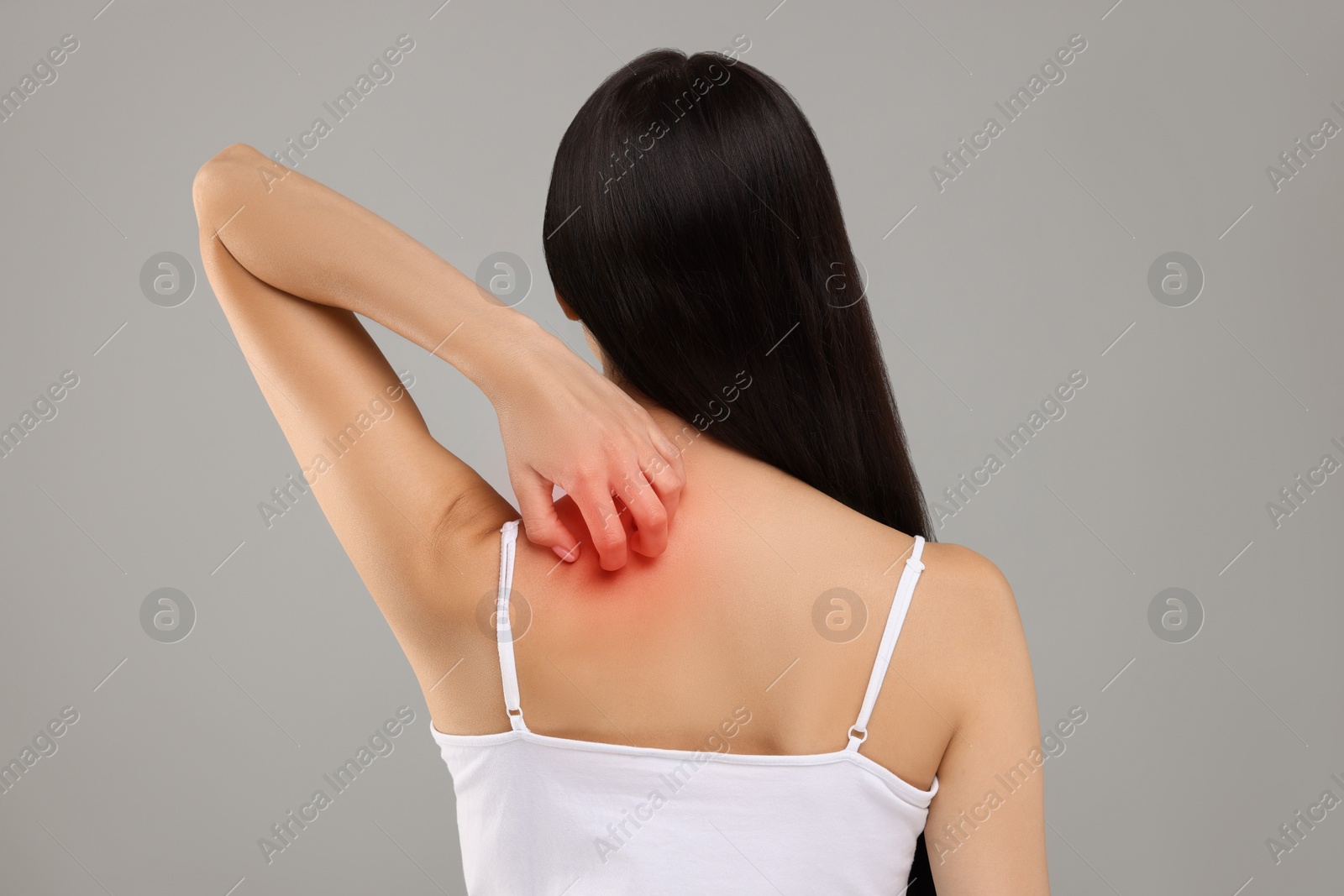 Photo of Suffering from allergy. Young woman scratching her skin on light grey background, back view