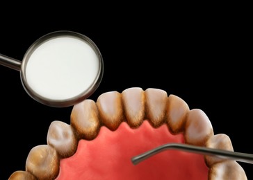 Image of Examining teeth with calculus on black background
