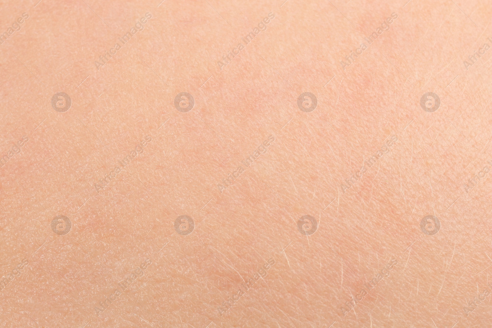 Photo of Texture of dry skin as background, macro view