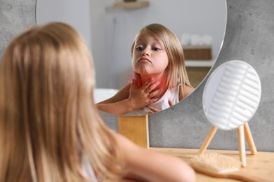 Suffering from allergy. Little girl looking in mirror and scratching her neck at home