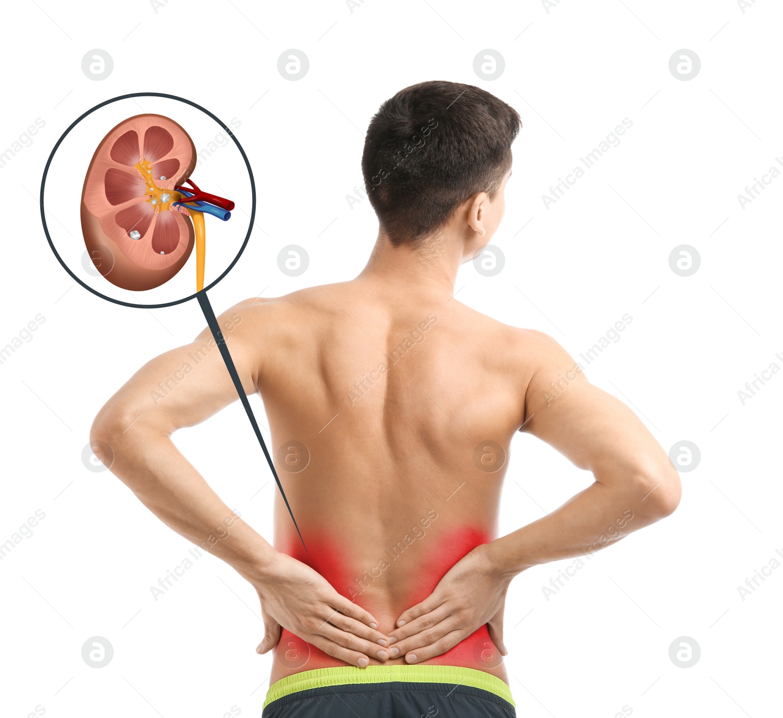 Image of Man suffering from pain because of kidney stones disease on white background