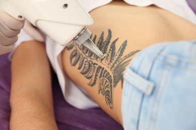 Photo of Young woman undergoing laser tattoo removal procedure in salon, closeup