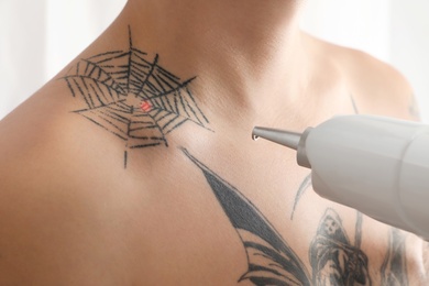 Photo of Man undergoing laser tattoo removal procedure in salon, closeup