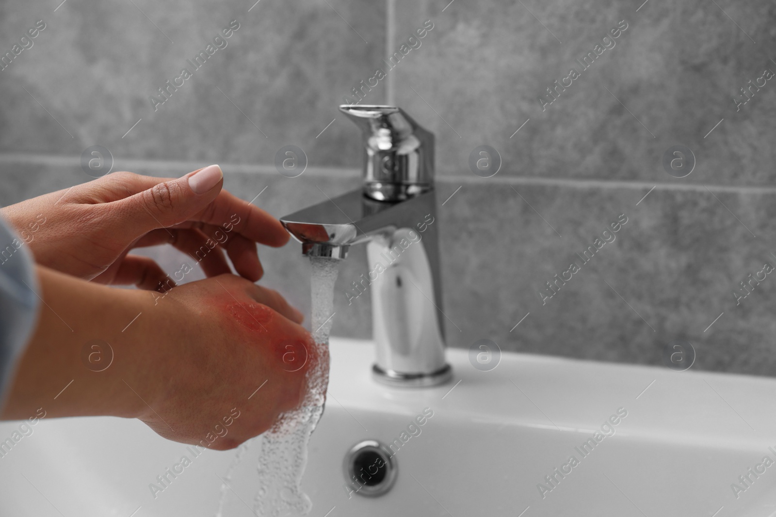 Photo of Woman holding burned hand under cold water indoors, closeup. Space for text